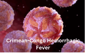 Crimean-Congo Hemorrhagic Fever 