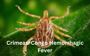 Crimean-Congo Hemorrhagic Fever 