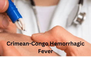 Crimean-Congo Hemorrhagic Fever 