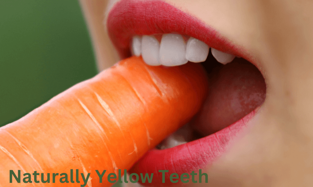 Naturally Yellow Teeth